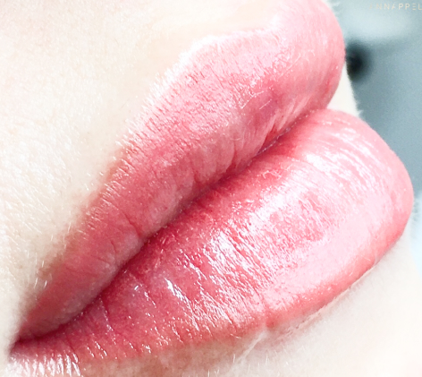 Lippen